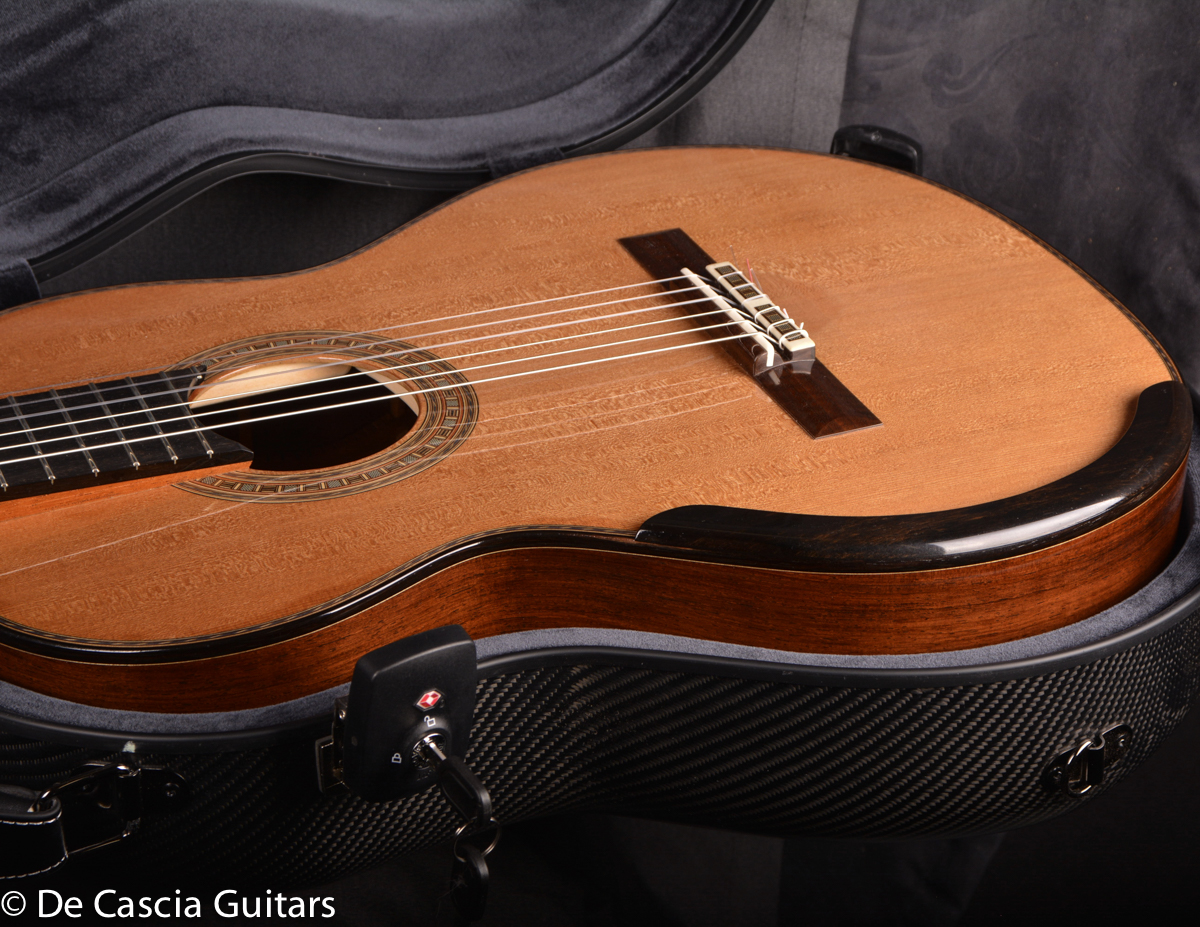 A-402, De Cascia Carbon Fiber Case - Image 12